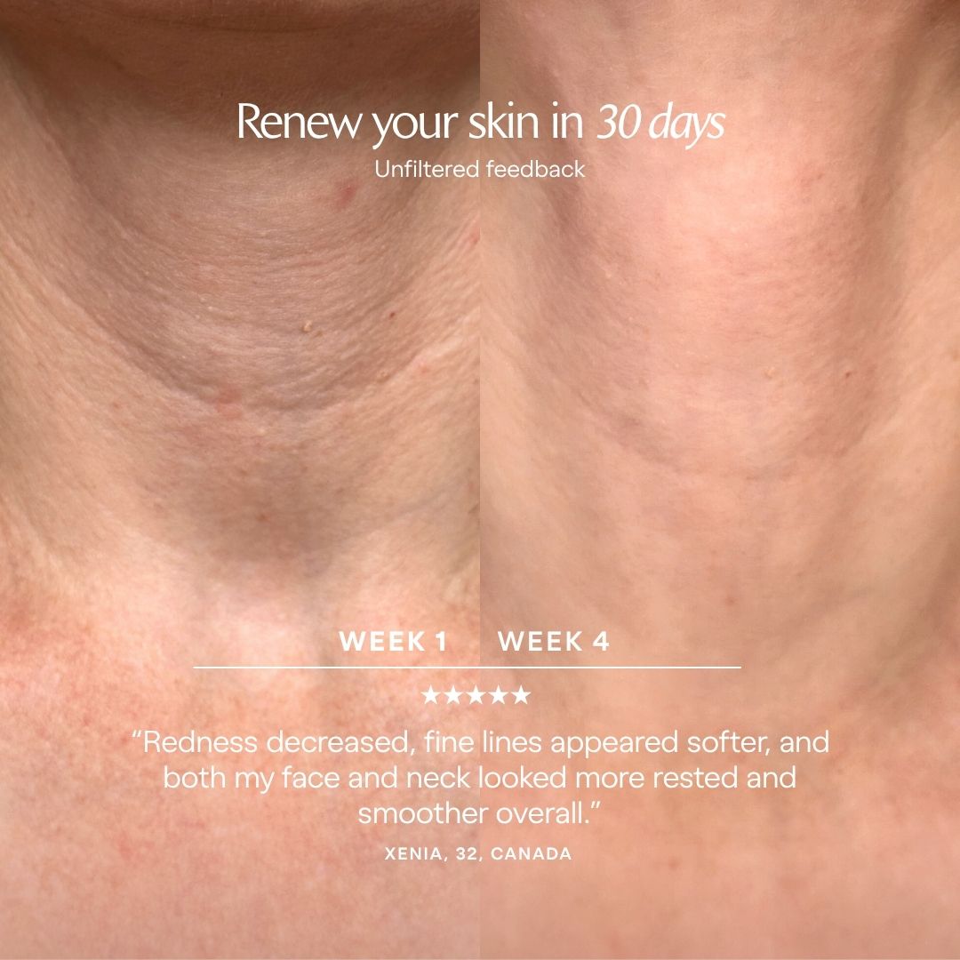 LumaLux Face+ | Pro LED Red Light Therapy Face & Neck Mask