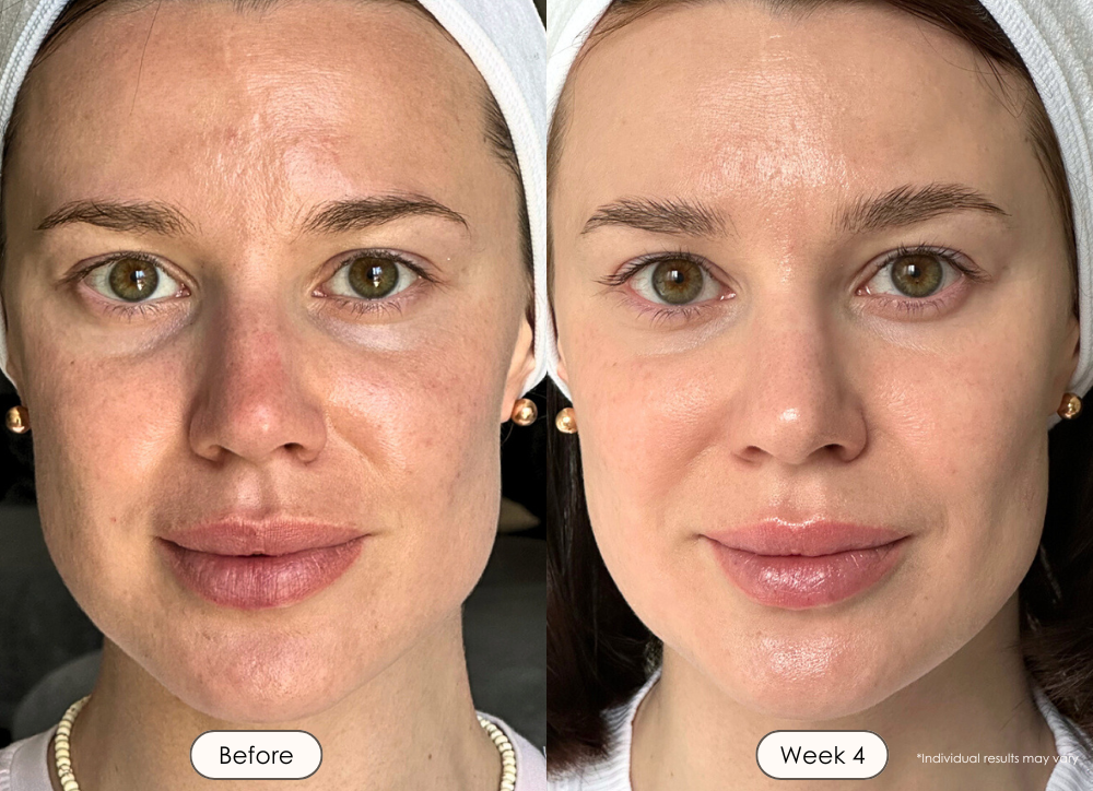 visible results after 4 weeks of using the LED light therapy mask