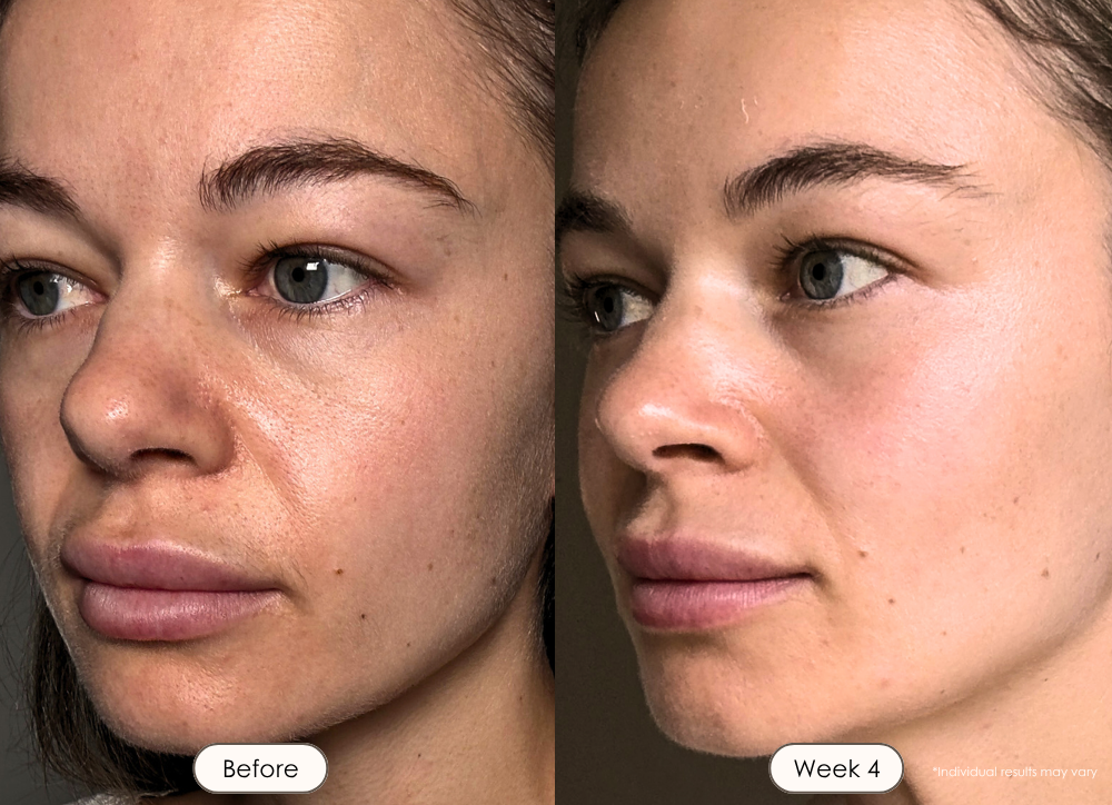 visible results after 4 weeks of using the LED light therapy mask