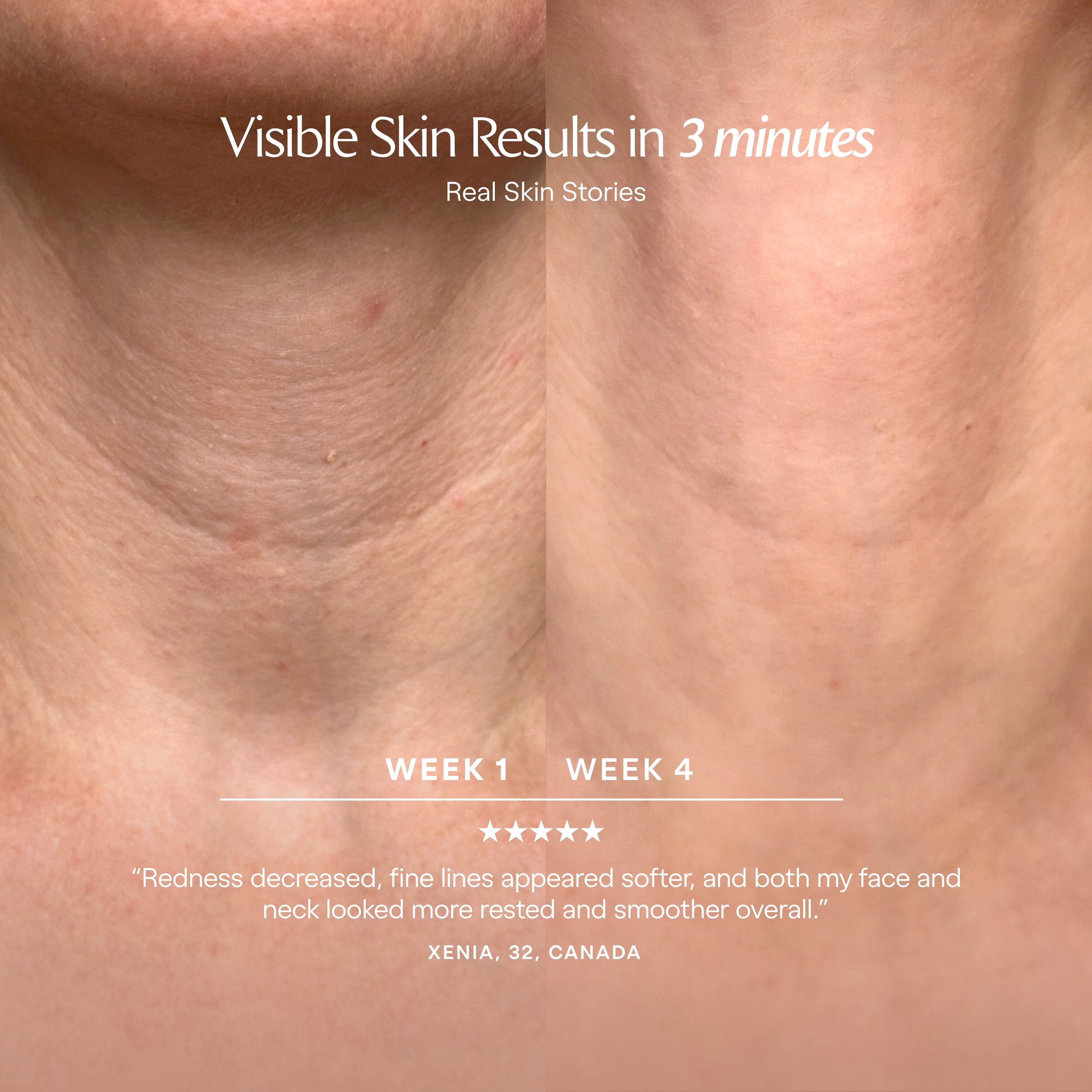 LumaLux Neck & Dec | Pro LED Red Light Therapy Mask - Project E Beauty